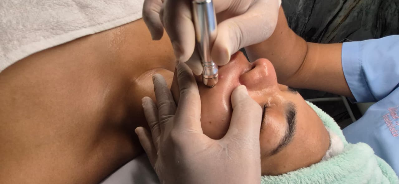 Limpieza facial profunda Valledupar
