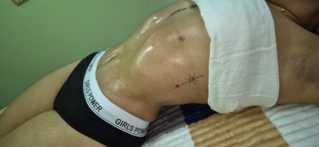 Aparatología estética Valledupar