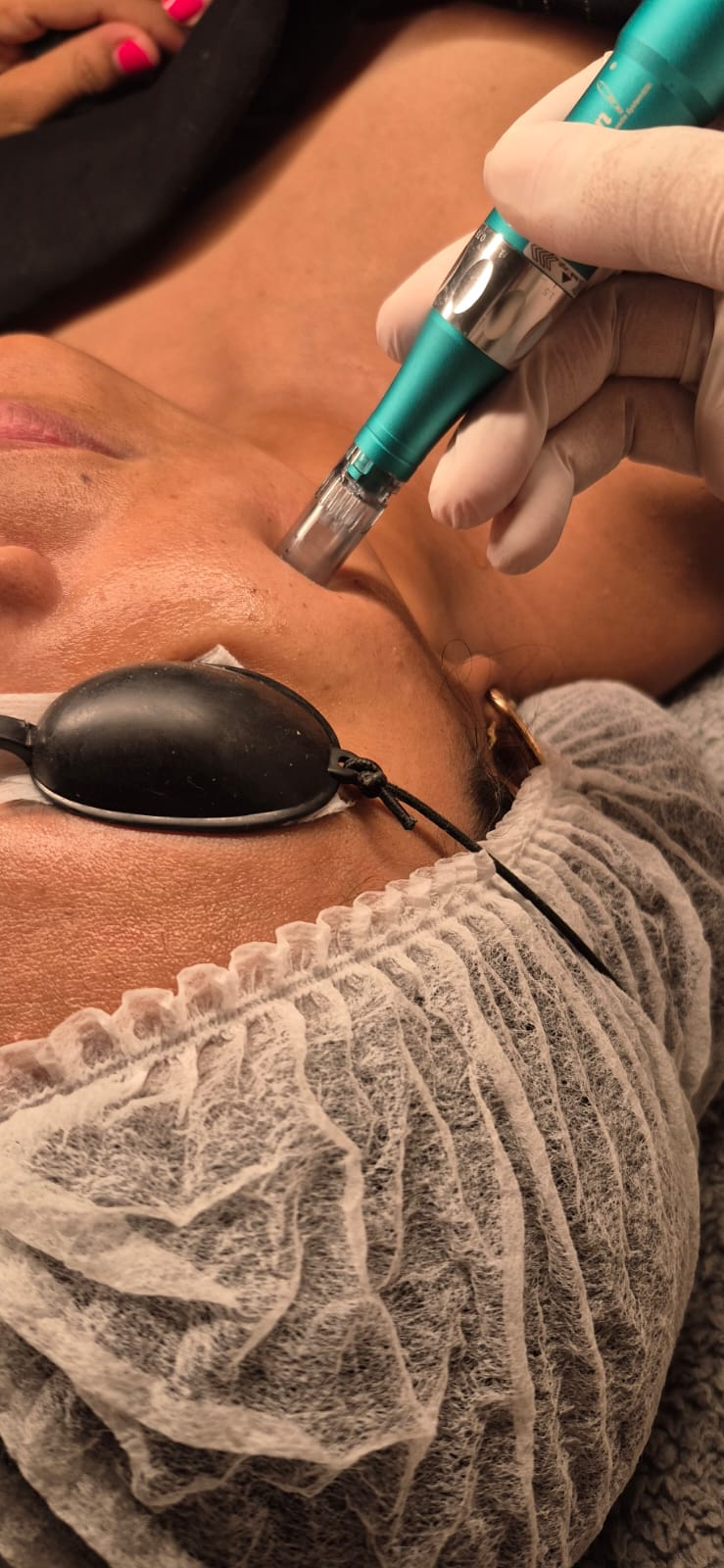 Tratamiento facial profundo LP Estética